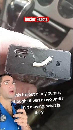 Doctor Reacts: tapeworm burger?!