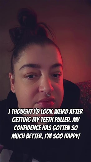 Boost Confidence After Tooth Extraction with Dentures