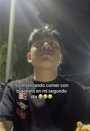 Superando el reto de comer con brackets en ortodoncia