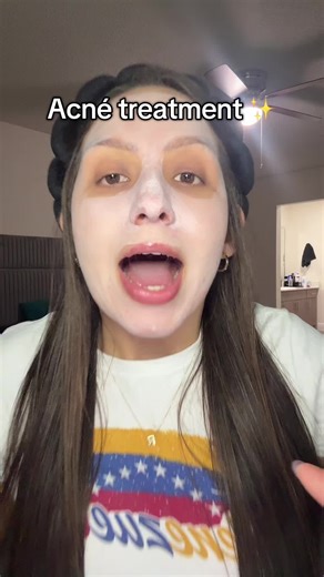 Si tienes piel Acneica y sufres puntos negros , esto a sido mi gran ayuda✨@Dr.Leo-USA #drleo #drleoclaymask #acnetreatment #beautyandlifestyledeals #tiktokshopblackfriday