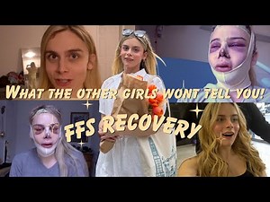An FFS Recovery Timeline