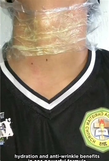 Achieve Neck Goals with KSECRET Retinal