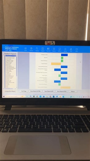 🌿 7 Months of Rooted Wellness Results 🌿 Personalized Health Protocol | Real Results | Nov. 2025 🧬 Cellular & Inflammation Improvements 📉 Inflammation dropped 36.4% 🧠 Nervous system stress reduced 46.2% 🌡️ Immune burden improved 31.6% 💓 Circulatory & Heart Health 🩸 Circulation & nitric oxide support improved by 50% 🫀 Cardiovascular system strengthened 25% 💪 Microvascular function improved 40.7% 🦠 Immune & Digestive Support 🧪 Enzyme utilization & absorption increased 35.7% 🛡️ Mucosal 