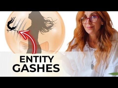 Why Entities Damage Your Sacral Chakra (And What to Do)