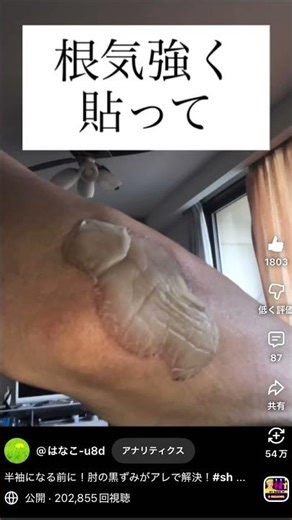 今でも反響たくさん🙏悩んでるそこのあなた！やってみてね#肘#黒ずみ#傷パワーパット