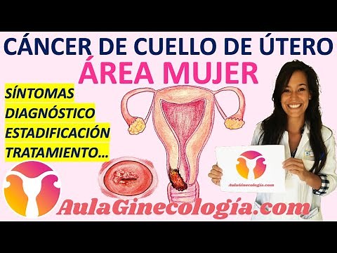 CÁNCER DE CUELLO DE ÚTERO: SÍNTOMAS, DIAGNÓSTICO, TRATAMIENTO... - Ginecología y Obstetricia -
