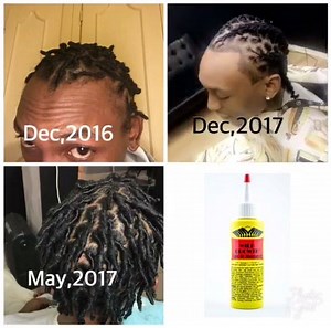 460K views · 795 reactions | Wild Growth Oils progress | Wild Growth Hair Care | Facebook