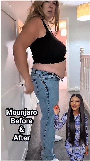 Mounjaro Amazing Weight Loss Before & After | Incredible Transformation