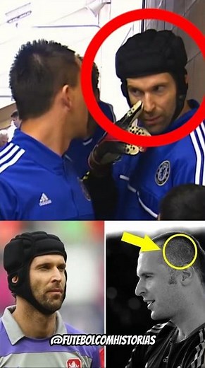 Por que Petr Cech usa capacete?