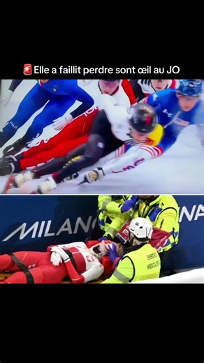 Kamila Sellier: Fracture à la pommette au JO 2026