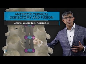 Anterior Cervical Diskectomy and Fusion
