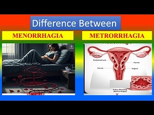Differences between Menorrhagia and Metrorrhagia