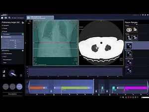 CT PULMONARY ANGIO TECHNIQUE IN CT SIEMENS SOMATOM GO NOW.. #ctscan #ctscanner #radiology #cttech