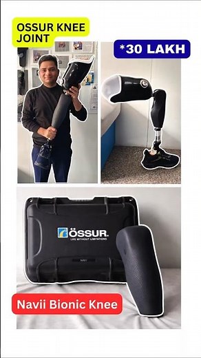 Navii Bionic Knee Prosthetic Leg | Smart Nakli Tang for Above Knee Amputees | Ossur KneeJoint #ossur