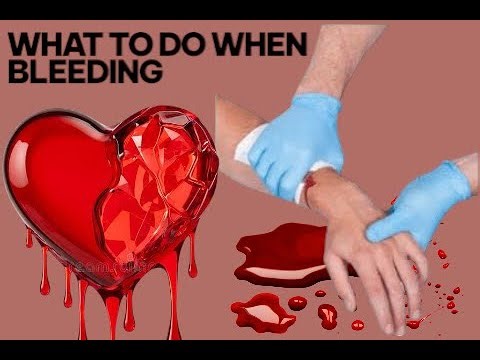 ESSENTIAL FIRST AID Bleeding treatment techniques unveiled