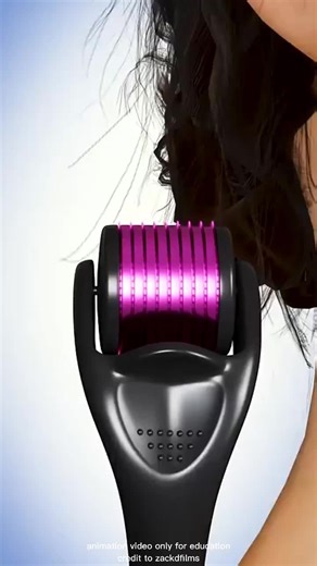 Benefits of Using a Derma Roller for Skin Health