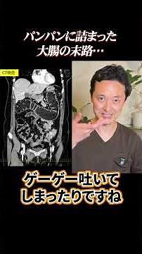 A Dangerously Distended Colon Caused by Advanced Bowel Cancer?! What Happens If It’s Left Untreated?
