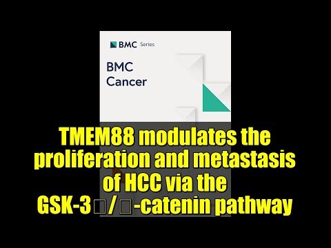 TMEM88 modulates the proliferation and metastasis of HCC via the GSK-3β/β-catenin pathway