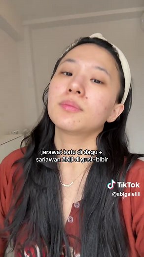 Mengatasi Jerawat Batu dan Sariawan di Dagu