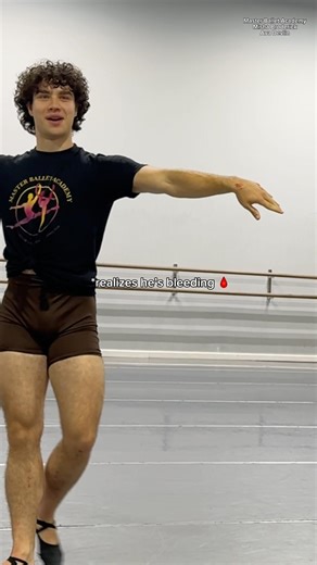 He got WHACKED🫣👃🩸 #ballet #pasdedeux #dancers #dancerlife #dancevideo