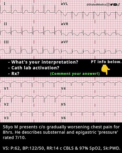 12 Lead EKG Practice interpretation