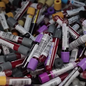 1.7K views · 42 reactions | Scaling lab operations and maintaining high standards of accuracy don’t have to be mutually exclusive. Read how Dr. Lal Pathlabs turned to process automation and IT. https://bit.ly/3q50kUm | Siemens Healthineers | Facebook