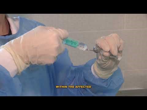 Everything You Need to Know About Gas Gangrene: Clostridium Perfringens Explained