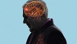 Video: How to Spot Symptoms of a Stroke