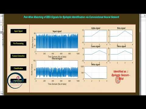 Pair Wise Matching of EEG Signals for Epileptic Seizures identification via CNN using MATLAB