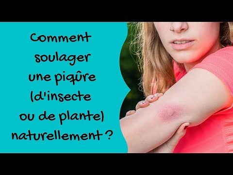 How to relieve an insect or plant sting naturally