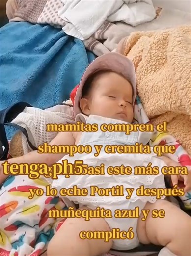 Tratamientos para sarpullido: Euserin y Portil