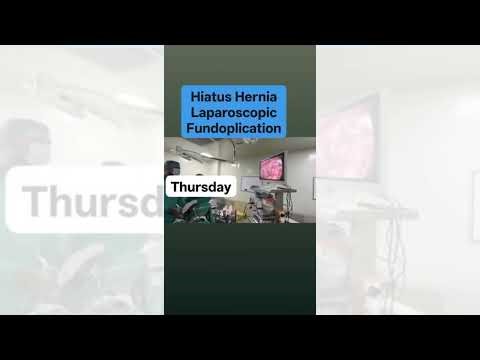 Hiatus Hernia Laparoscopic Fundoplication | Advanced Minimally Invasive Surgery at Sarwal Hospital