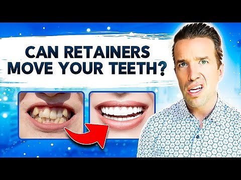 Can Retainers Move Your Teeth | Retainers