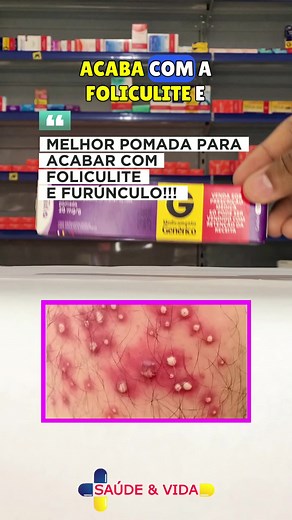 MELHOR POMADA PARA ACABAR COM FOLICULITE E FURUNCULO…🤩😱 #farmacia #d...