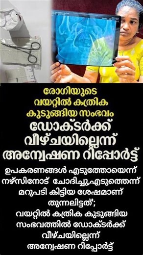 ഡോക്ടർ നിരപരാധി രോഗിയുടെ വയറ്റിൽ കത്രിക കുടുങ്ങിയത് ഡോക്ടറുടെ വീഴ്ചയല്ല#latestnews #breakingnews