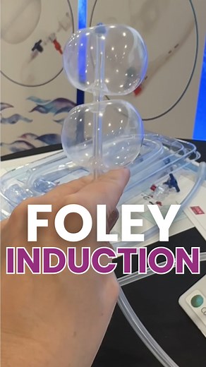 There are many ways labor can be induced so you can have a baby. This video goes over a cook catheter or foley bulb for the induction of labor. The two balloons seen here are inflated putting pressure on both sides of the cervix as a way to get it ready for labor and childbirth. Did you have labor induction or a foley bulb labor induction? #laborinduction #givingbirth #havingababy #birthprep #birthtips #expectingmom | Mama Nurse Tina