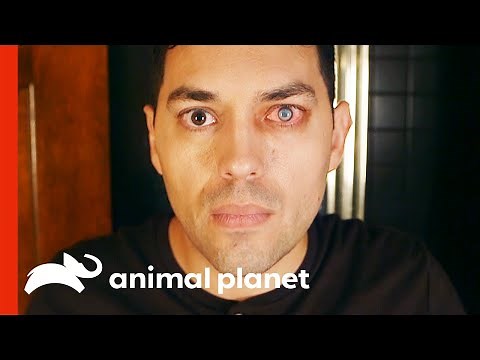 Parasite Feeds Off Man's Eye | Monsters Inside Me