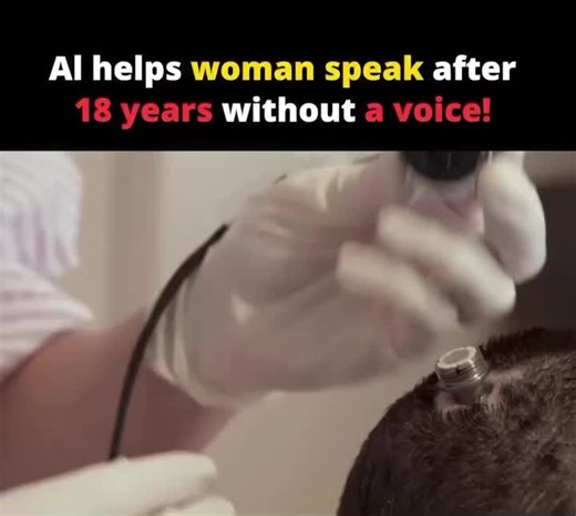 Medigorithm on Instagram: "She lost her voice for 18 years until AI helped restore it. For nearly two decades, she lived in complete silence, communicating only through eye movements and gestures. A severe neurological injury had taken away her ability to speak, cutting off one of the most fundamental human capacities: verbal expression. That changed with a breakthrough in brain–computer interface technology. Using AI-powered neural implants, researchers were able to decode patterns in her brain