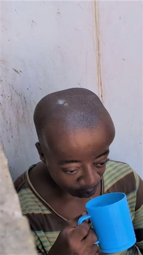 he has a very big head 😲😱bigger tha everyone alse 's😂