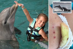 Vicious dolphin attacks are on the rise as 10-year-old is mauled on holiday