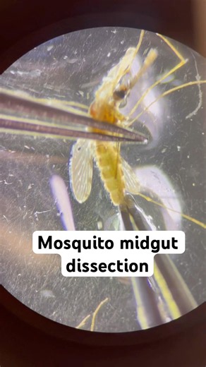 #mosquito #dissection #mosquitoes #insects #science #biology #mozzie #research #malaria #mosquito