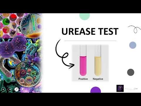 THE UREASE TEST