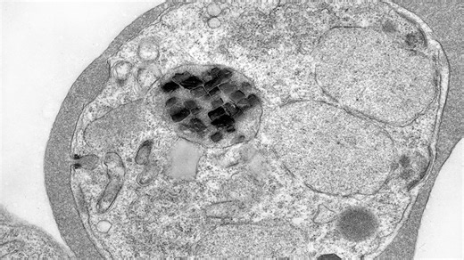Malaria parasites are full of wildly spinning iron crystals. Scientists finally know why - @theU