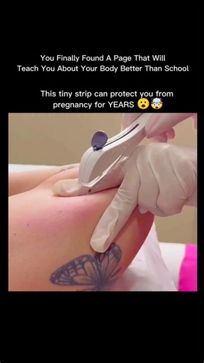 EXPLAINING OUR BODY | A contraceptive implant is a small, flexible strip placed under the skin of your upper arm by a healthcare professional. It releases... | Instagram