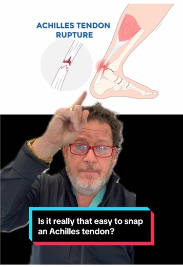 Is it really that easy to snap in Achilles tendon? 🦵💥 Most people think Achilles tendon ruptures only happen to high-intensity athletes. In reality, it can happen to almost anyone, a sudden push-off, jump, sprint, or quick change in direction can put too much force on the tendon and cause it to tear. Schedule Your Consultation Today! Progressive Spine & Orthopaedics 📲 201-227-1299 💻 www.progressivespine.com NEW JERSEY LOCATIONS: 📍Englewood (Bergen County) 📍Edison (Middlesex County) 📍Clift