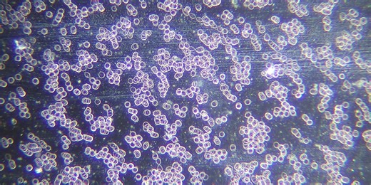 Live Blood Analysis in Acapulco