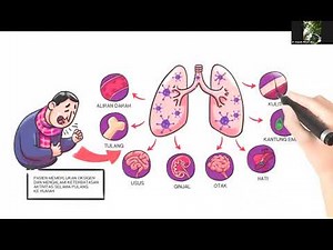Webinar Update SEPSIS 2021