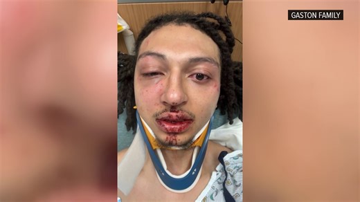Amazon worker says he was beaten by group outside Rossford facility as security looked on