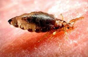 Where Do Lice Come from? Causes & Remedies • Pest Information and Prevention Tips | PestNile