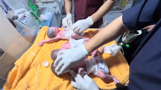 42K views · 1.4K reactions | Identical (monozygotic): All three come...